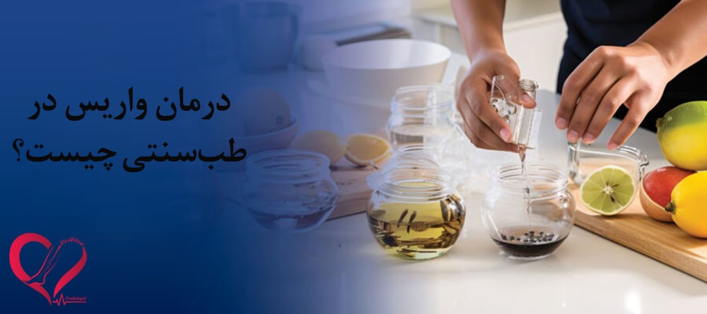 درمان واریس در طب سنتی
