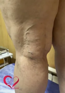 55