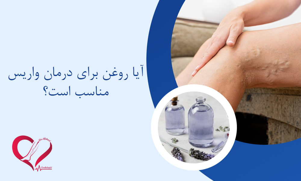 روغن برای درمان واریس