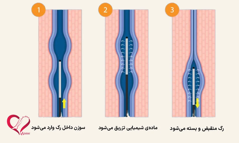 فرکانس رادیویی