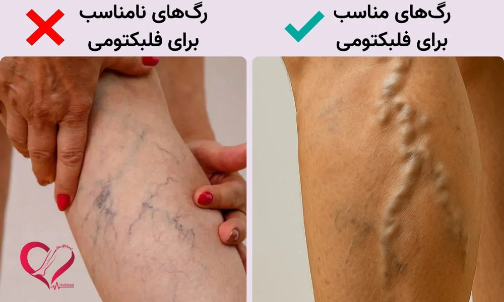 رگ‌ها فقط به‌صورت خطوط مویی و قرمز