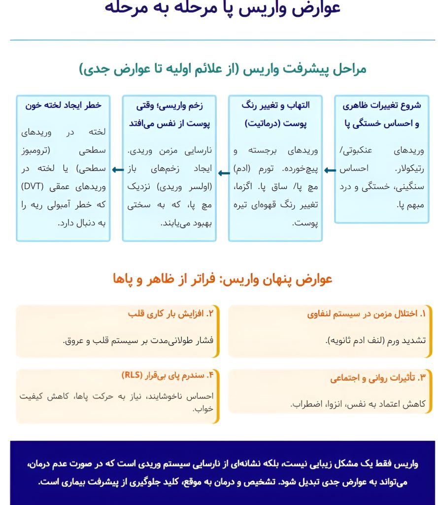 عوارض واریس