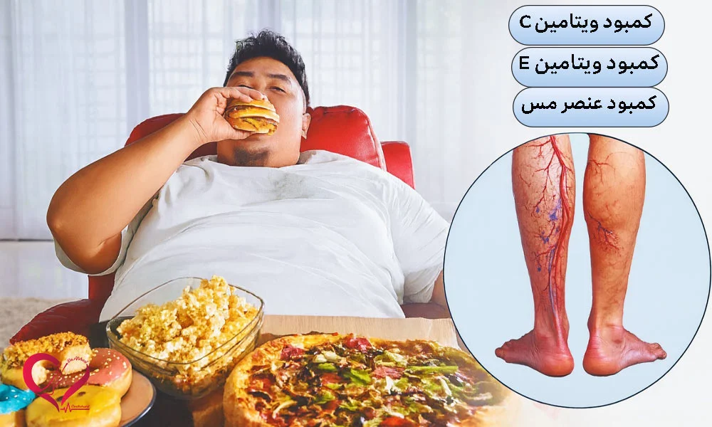 علت ششم: تغذیه ناسالم و کمبود مواد معدنی