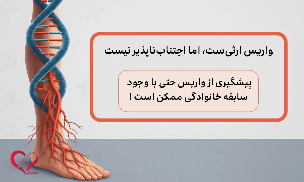 علت‌ اول ایجاد واریس: ضعف دیواره‌ی رگ‌ها و ژنتیک 